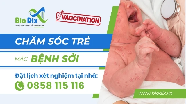CHĂM SÓC TRẺ MẮC SỞI TẠI NHÀ